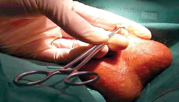 SCROTUM